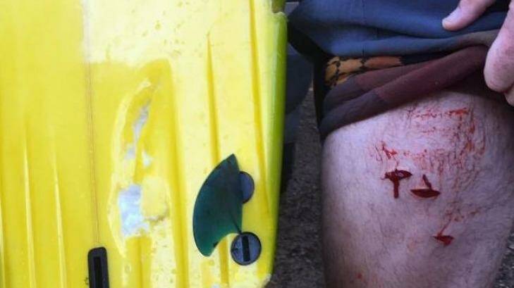 An image posted to social media shows several deep wounds to the surfer's thigh and bite marks on his surfboard. Photo: Geoffrey John Knapp