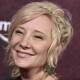 Anne Heche suffered "a significant pulmonary injury" and burns, her representatives say. (AP PHOTO)